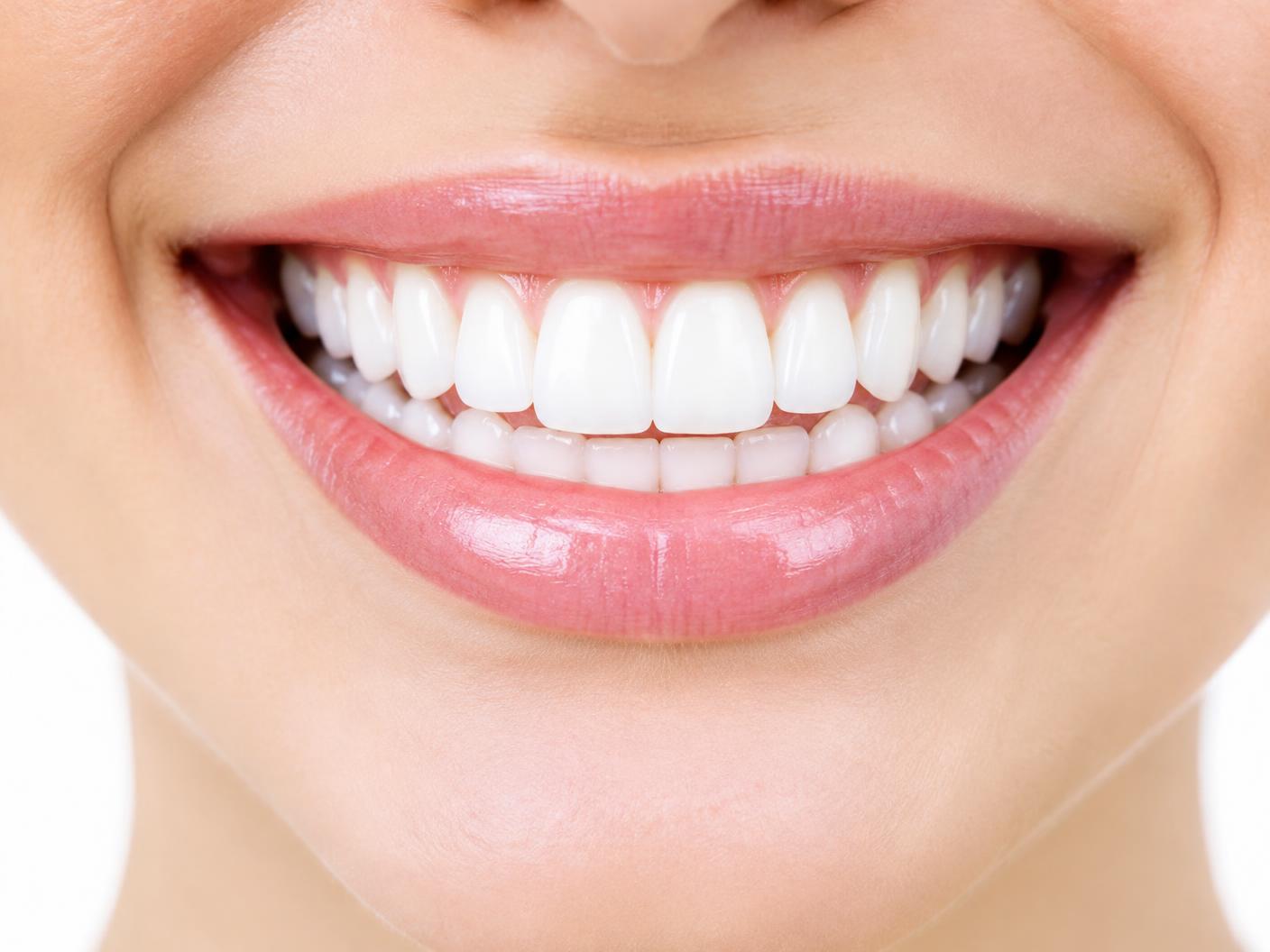Bright close-up photograph of a healthy, natural smile